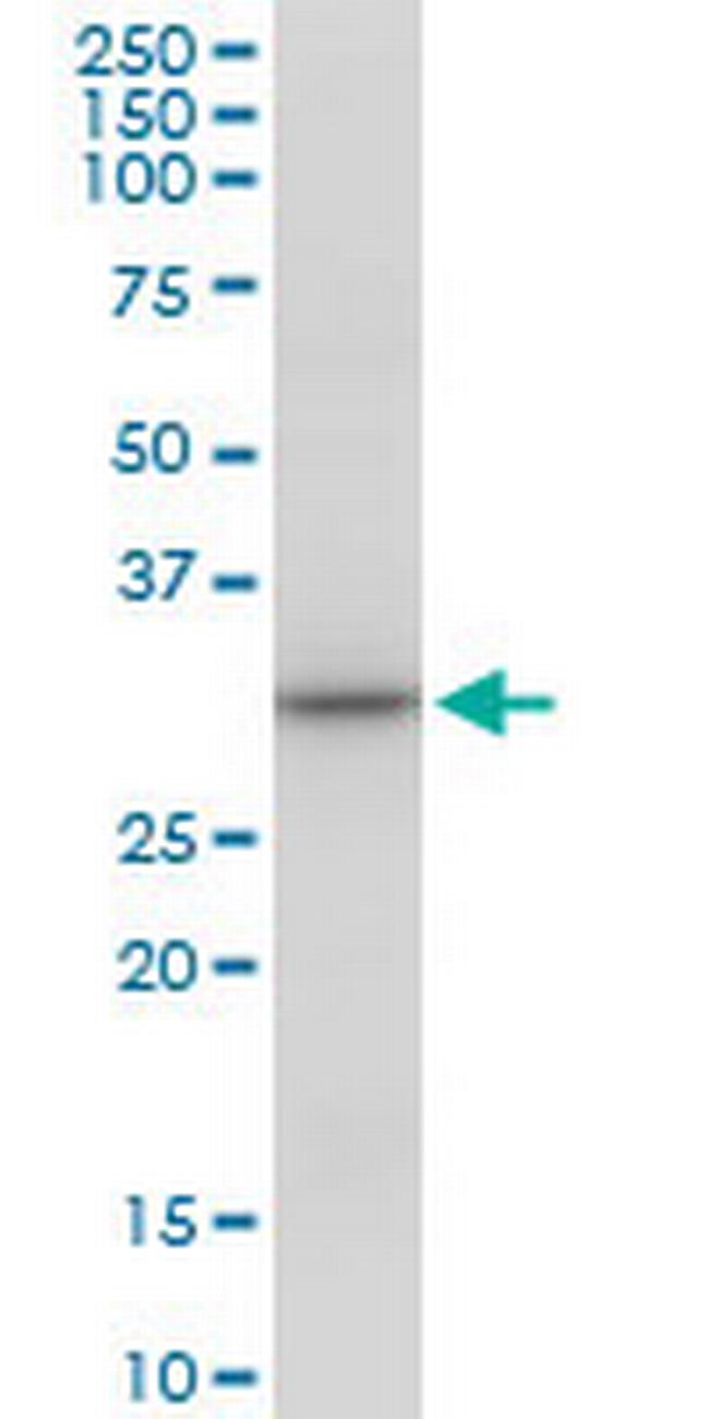 SULT1A3 Antibody in Western Blot (WB)