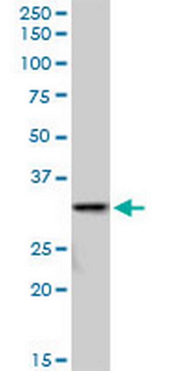 SULT1A3 Antibody in Western Blot (WB)