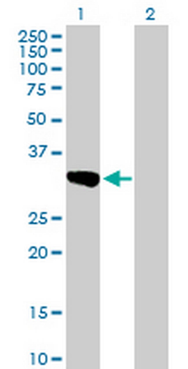 SULT1C1 Antibody in Western Blot (WB)