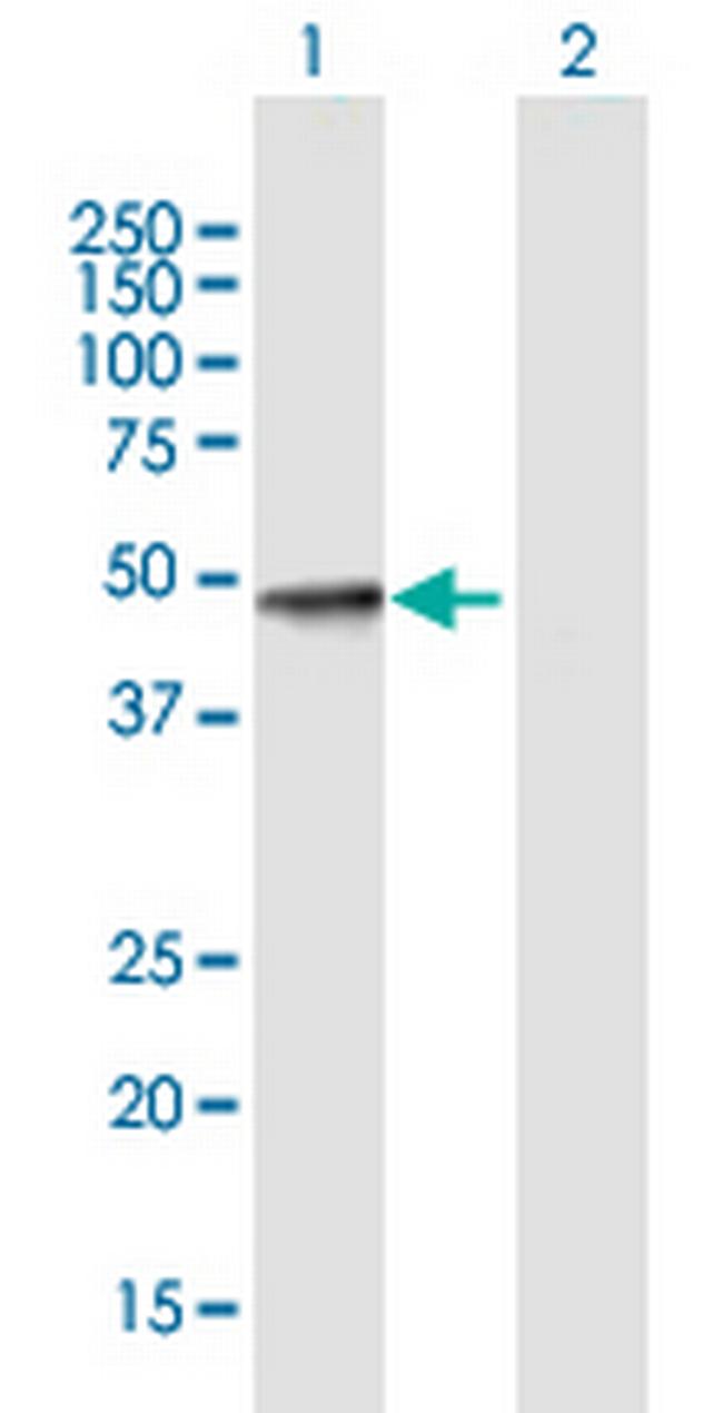 SULT2B1 Antibody in Western Blot (WB)