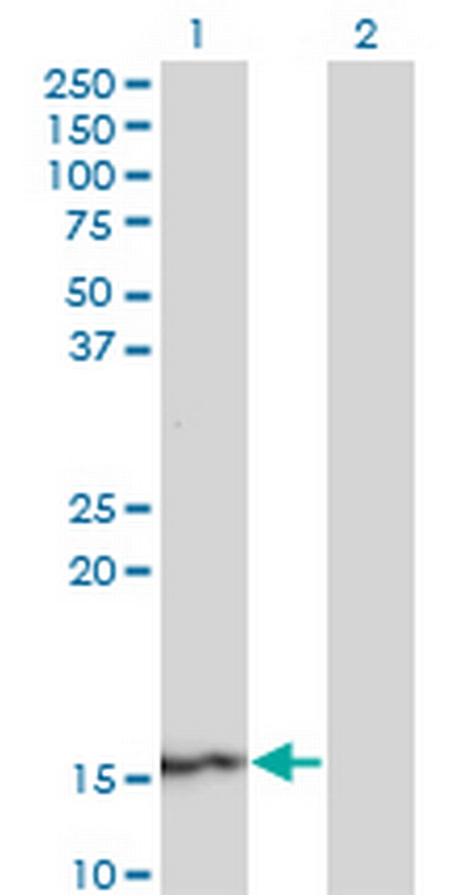 SUPT4H1 Antibody in Western Blot (WB)