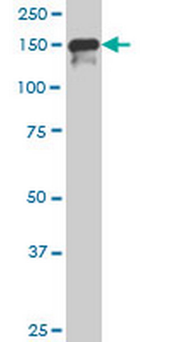 SUPT5H Antibody in Western Blot (WB)