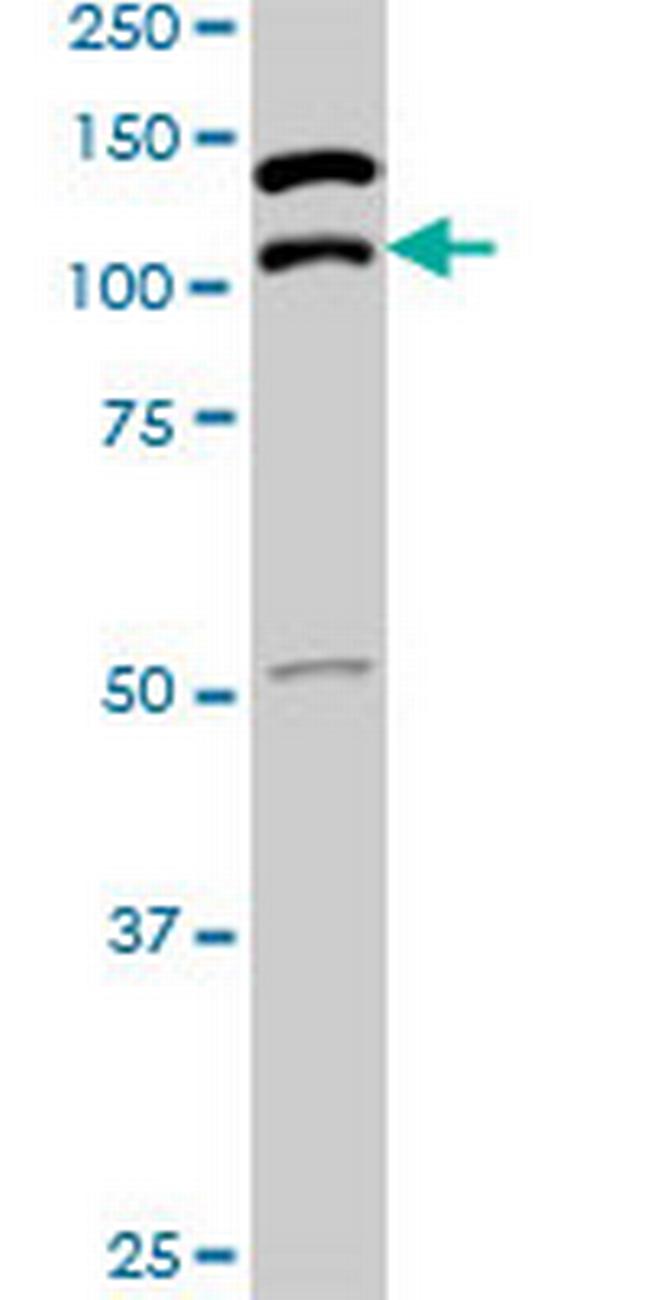 SUPT5H Antibody in Western Blot (WB)