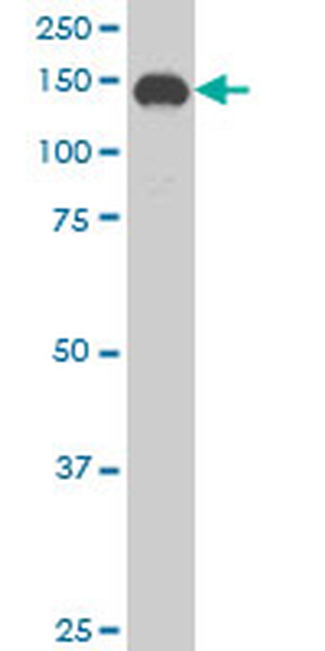 SUPT5H Antibody in Western Blot (WB)