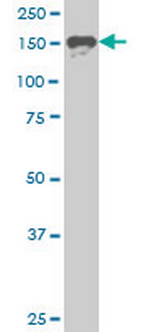SUPT5H Antibody in Western Blot (WB)