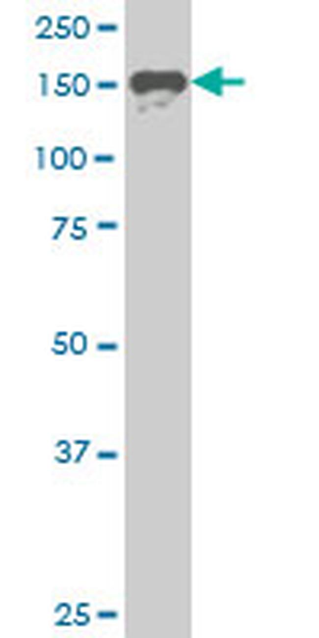 SUPT5H Antibody in Western Blot (WB)