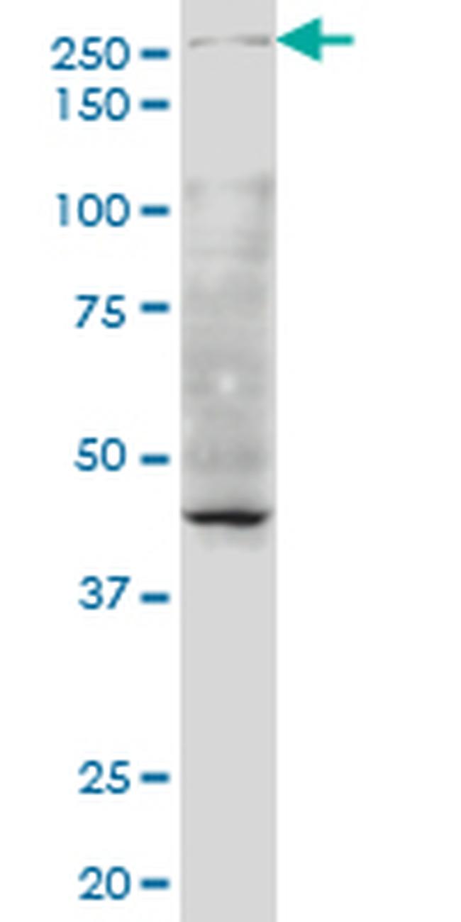 TAF1 Antibody in Western Blot (WB)