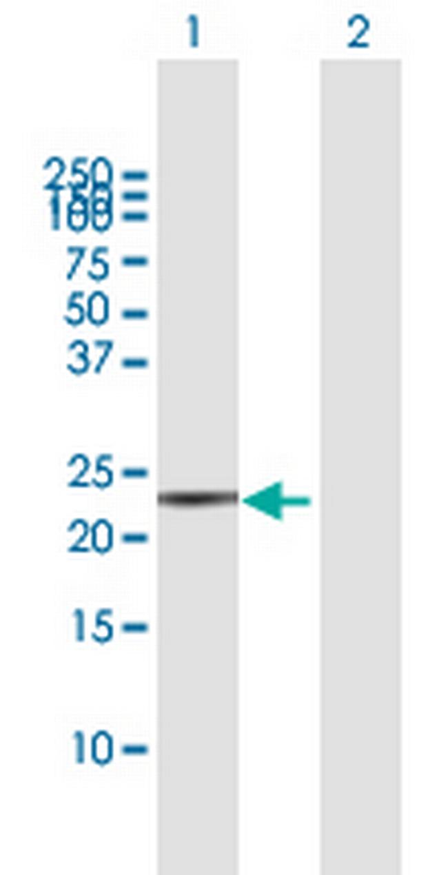 TAGLN Antibody in Western Blot (WB)