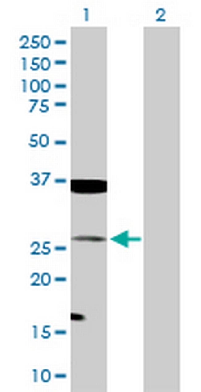 TAGLN Antibody in Western Blot (WB)