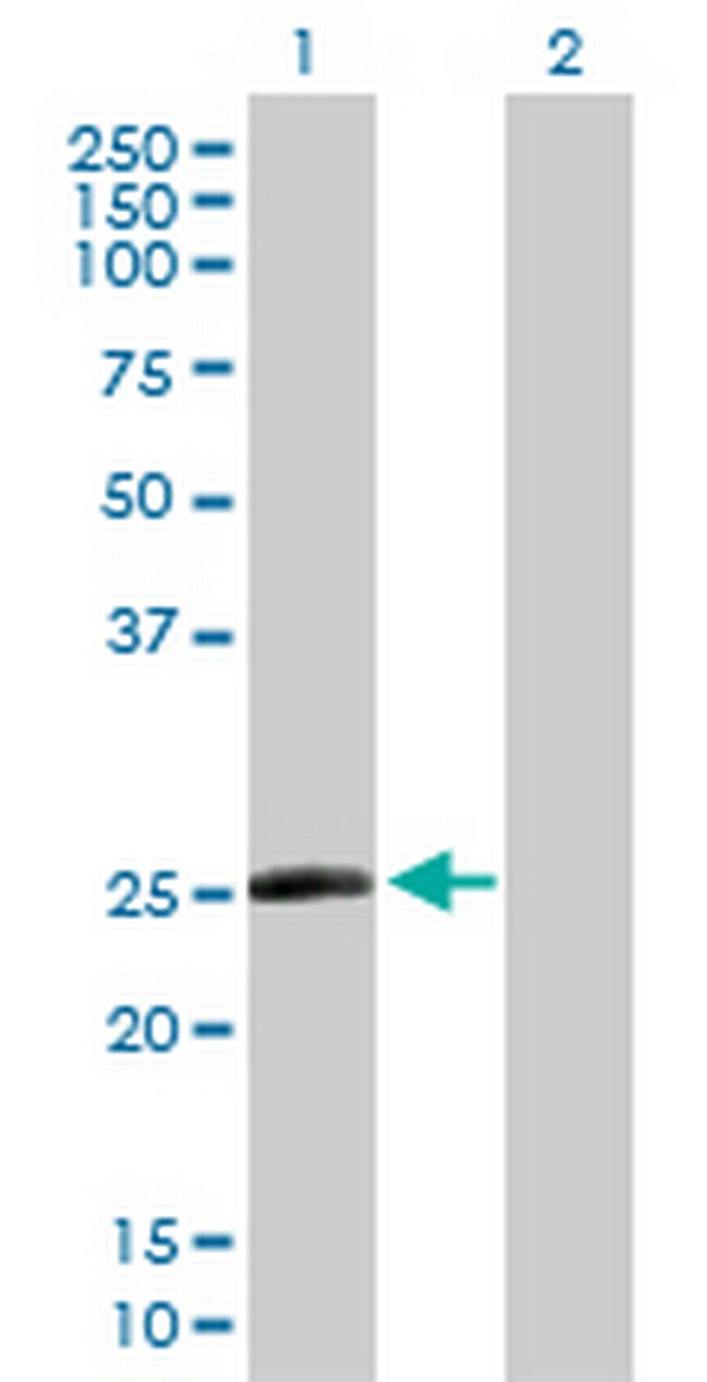TAF10 Antibody in Western Blot (WB)