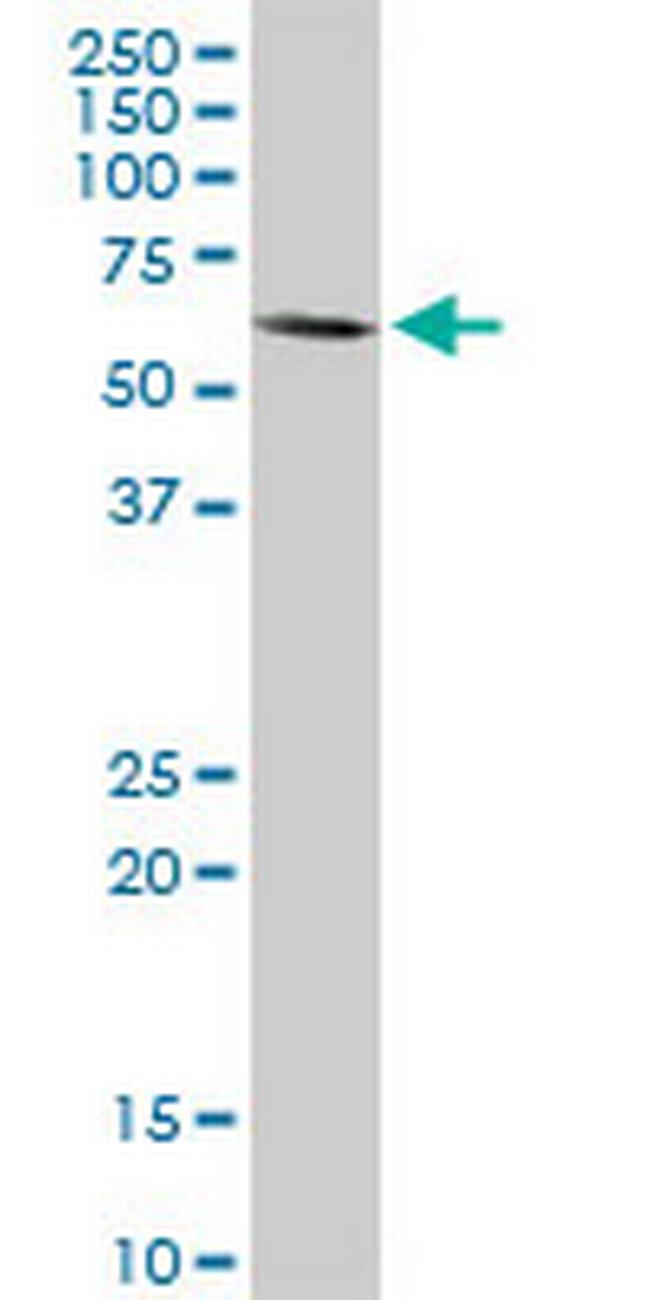 MAP3K7 Antibody in Western Blot (WB)