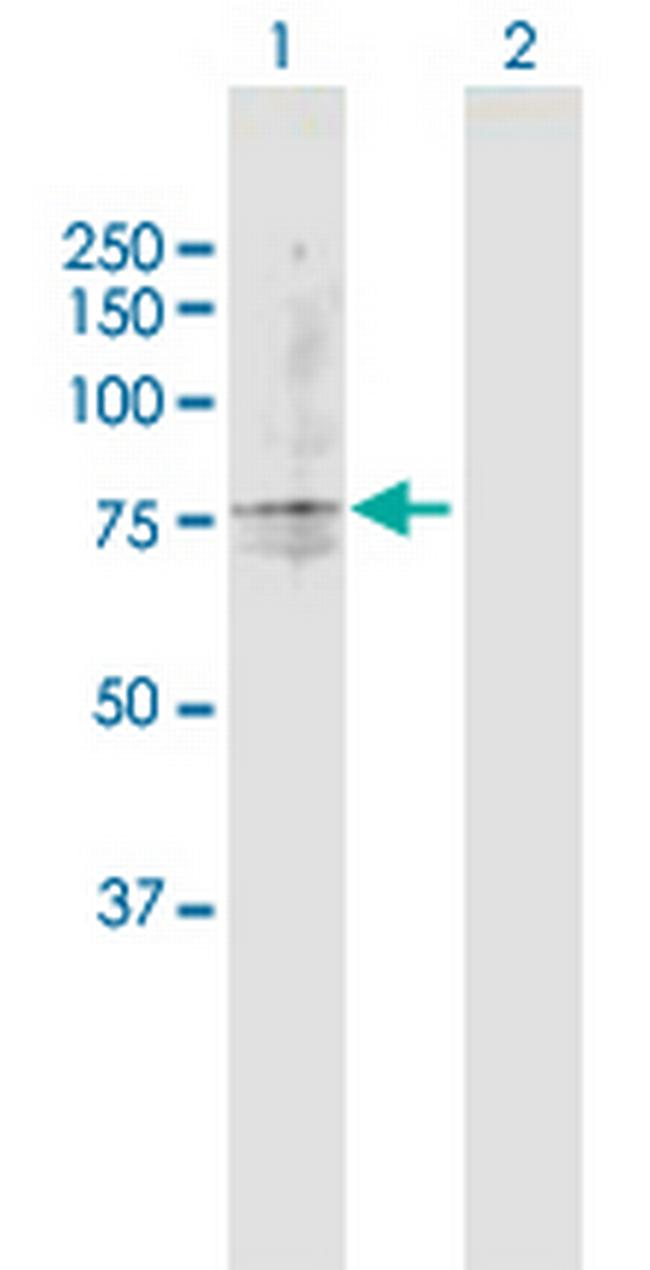 TAP2 Antibody in Western Blot (WB)
