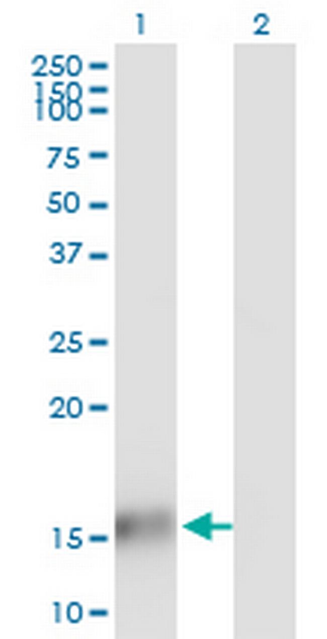 TBCA Antibody in Western Blot (WB)