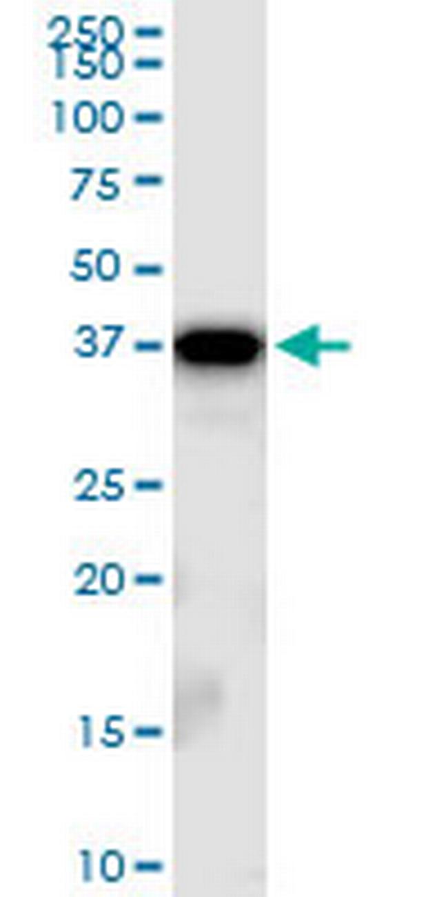 TBCC Antibody in Western Blot (WB)