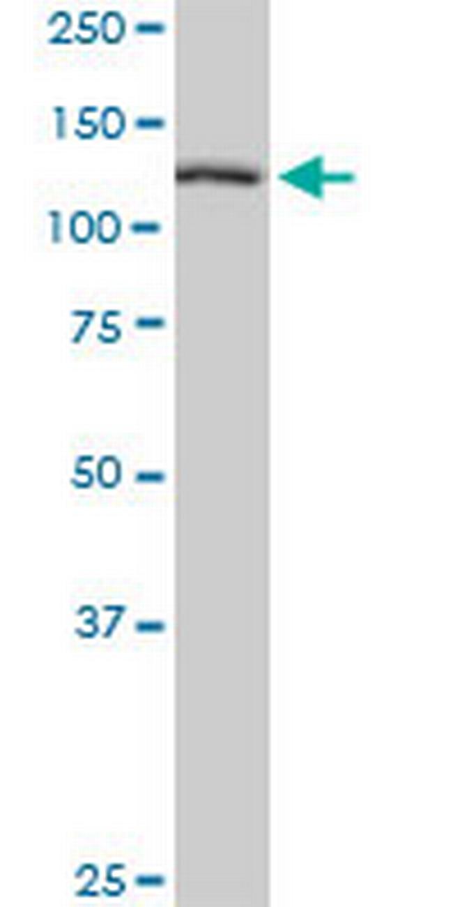 TBCD Antibody in Western Blot (WB)