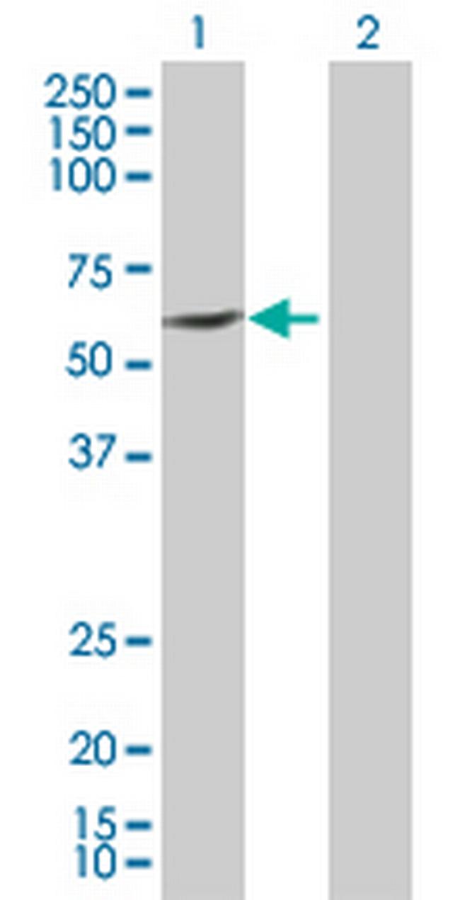 TBXAS1 Antibody in Western Blot (WB)