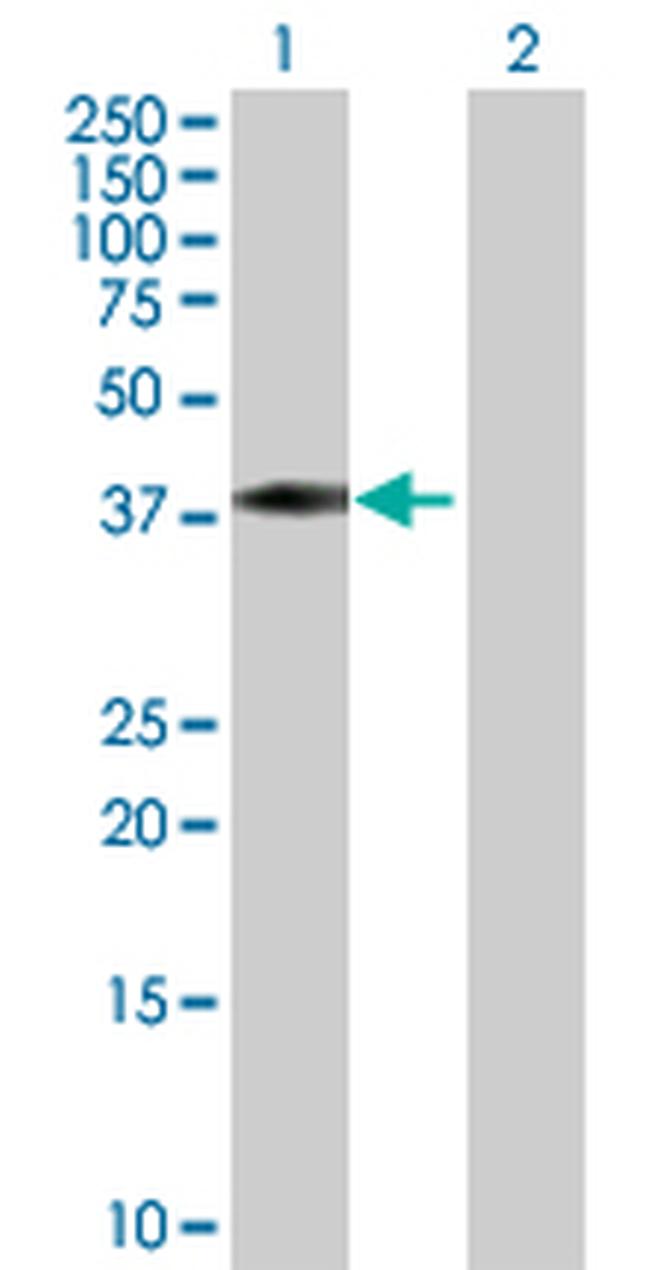TCEA3 Antibody in Western Blot (WB)