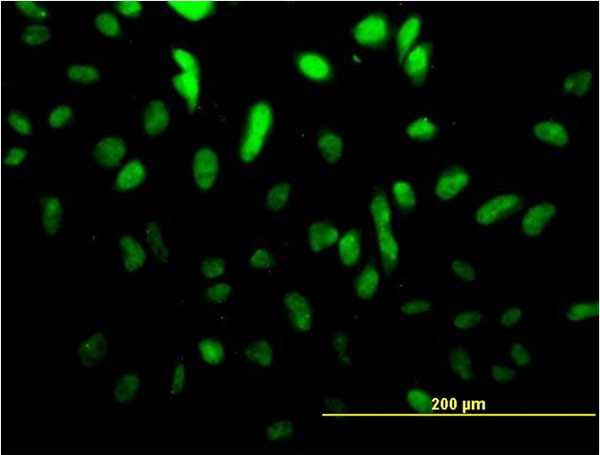 TCF4 Antibody in Immunocytochemistry (ICC/IF)
