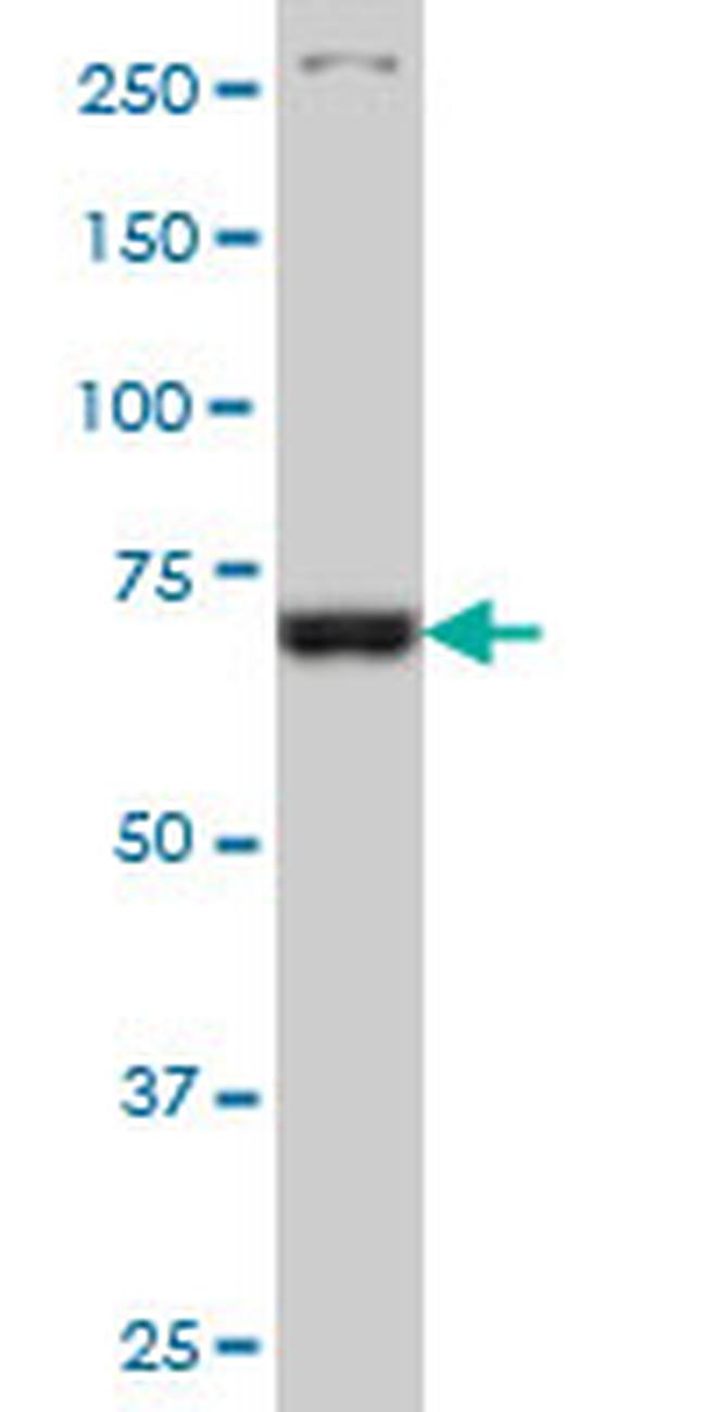 TBX3 Antibody in Western Blot (WB)