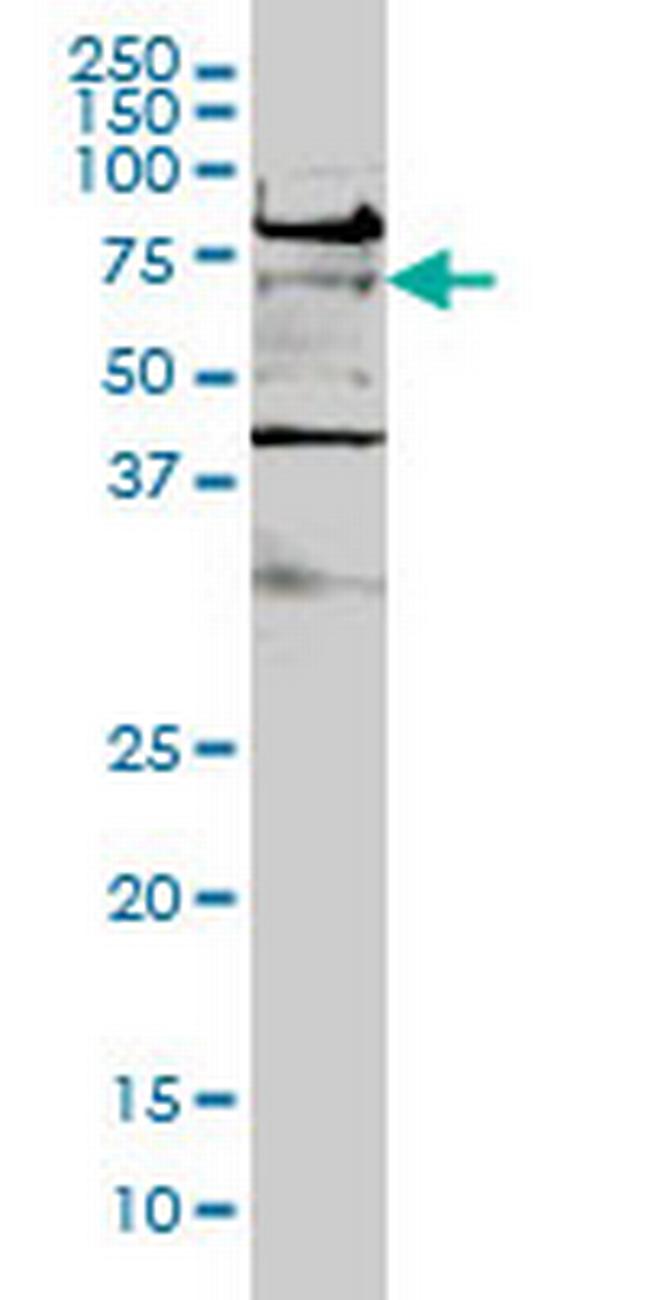 TCF7L2 Antibody in Western Blot (WB)