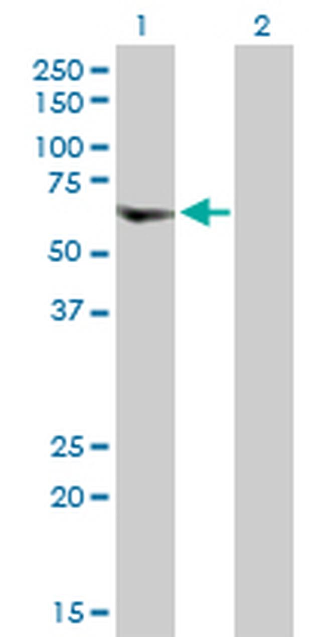 VPS72 Antibody in Western Blot (WB)