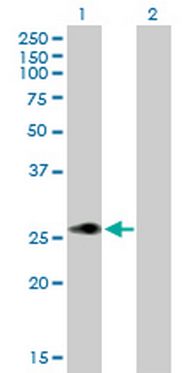 MLX Antibody in Western Blot (WB)