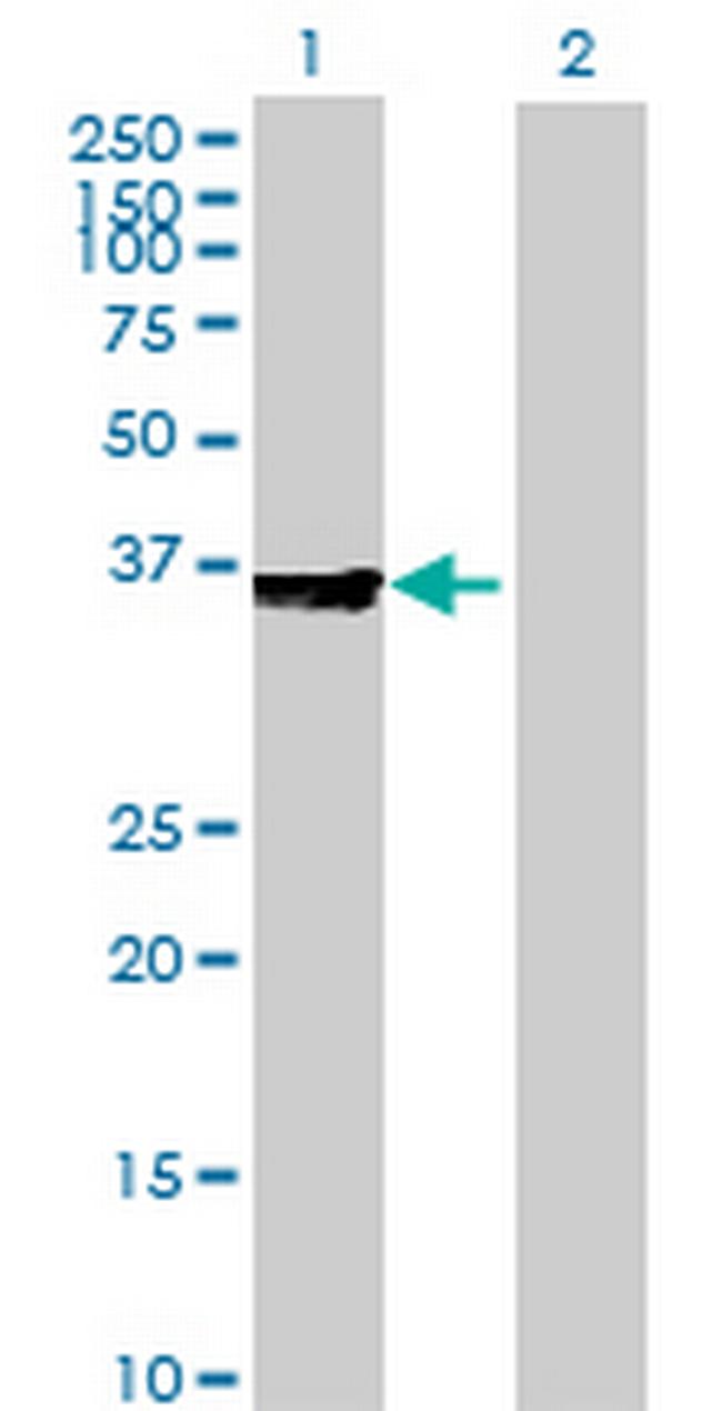 TRA Antibody in Western Blot (WB)