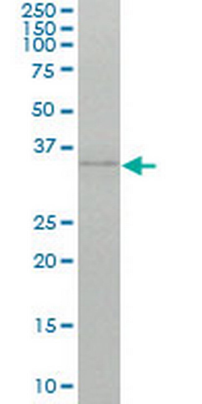 TRD Antibody in Western Blot (WB)