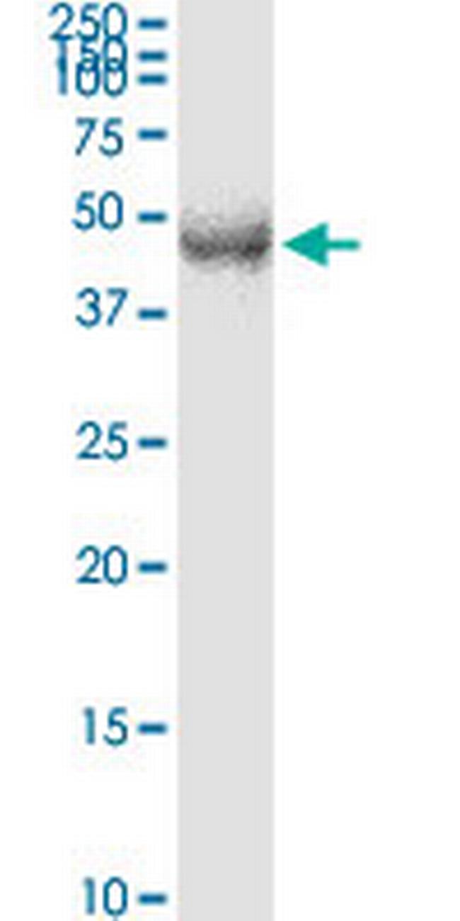 TFDP2 Antibody in Western Blot (WB)