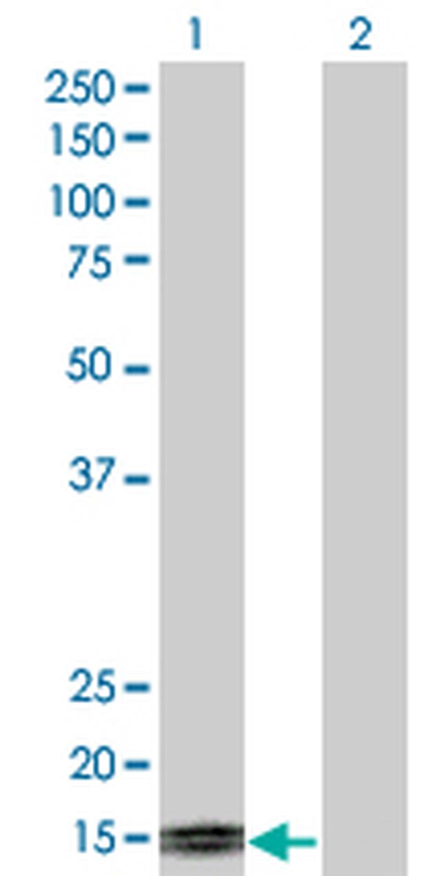 TFF1 Antibody in Western Blot (WB)