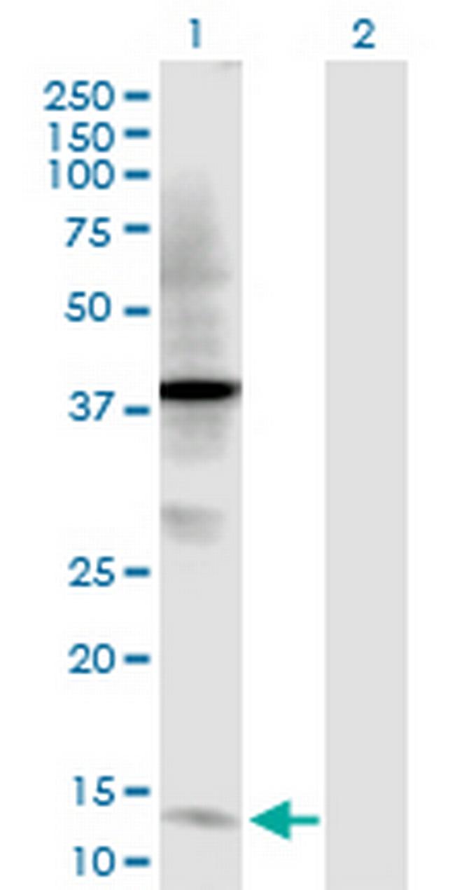 TFF2 Antibody in Western Blot (WB)