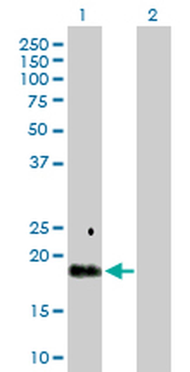 TGFA Antibody in Western Blot (WB)