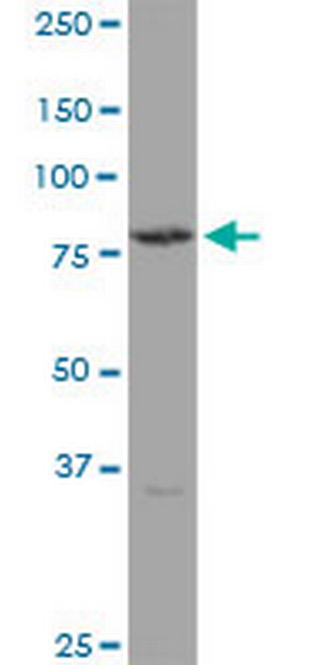 TGM4 Antibody in Western Blot (WB)