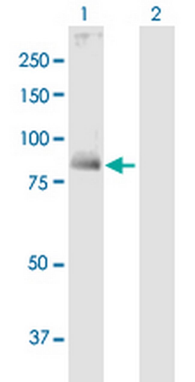 TGM1 Antibody in Western Blot (WB)