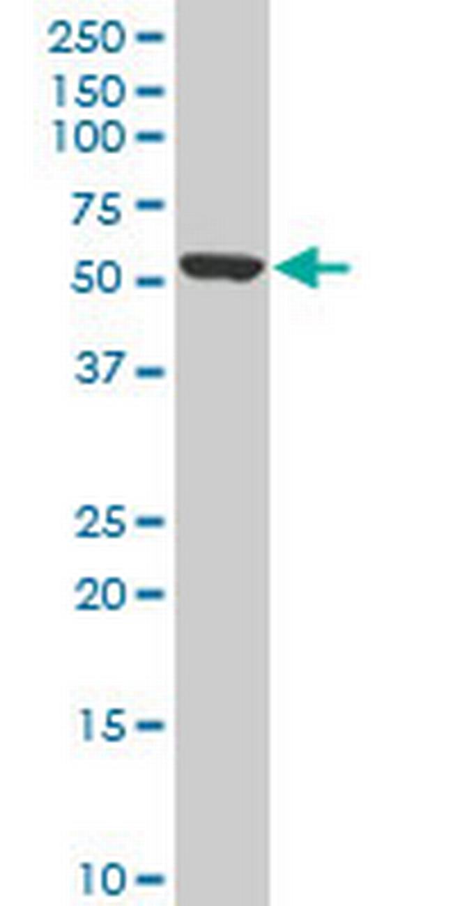 KLF10 Antibody in Western Blot (WB)