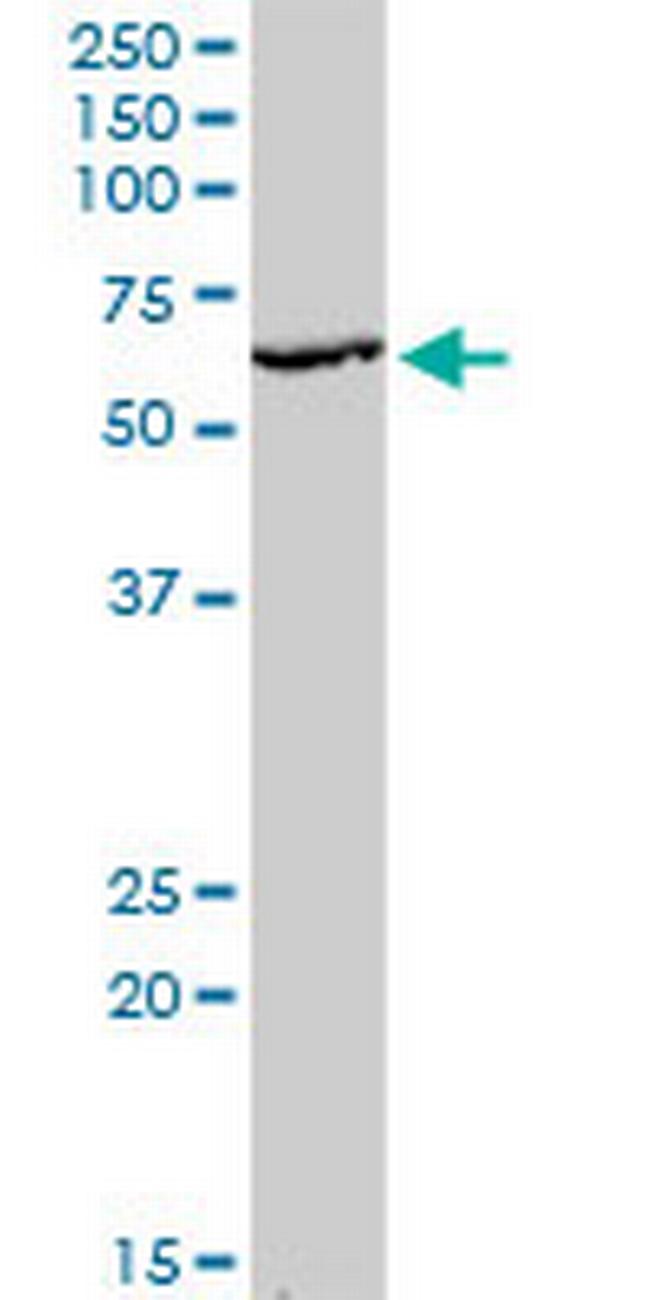 KLF10 Antibody in Western Blot (WB)