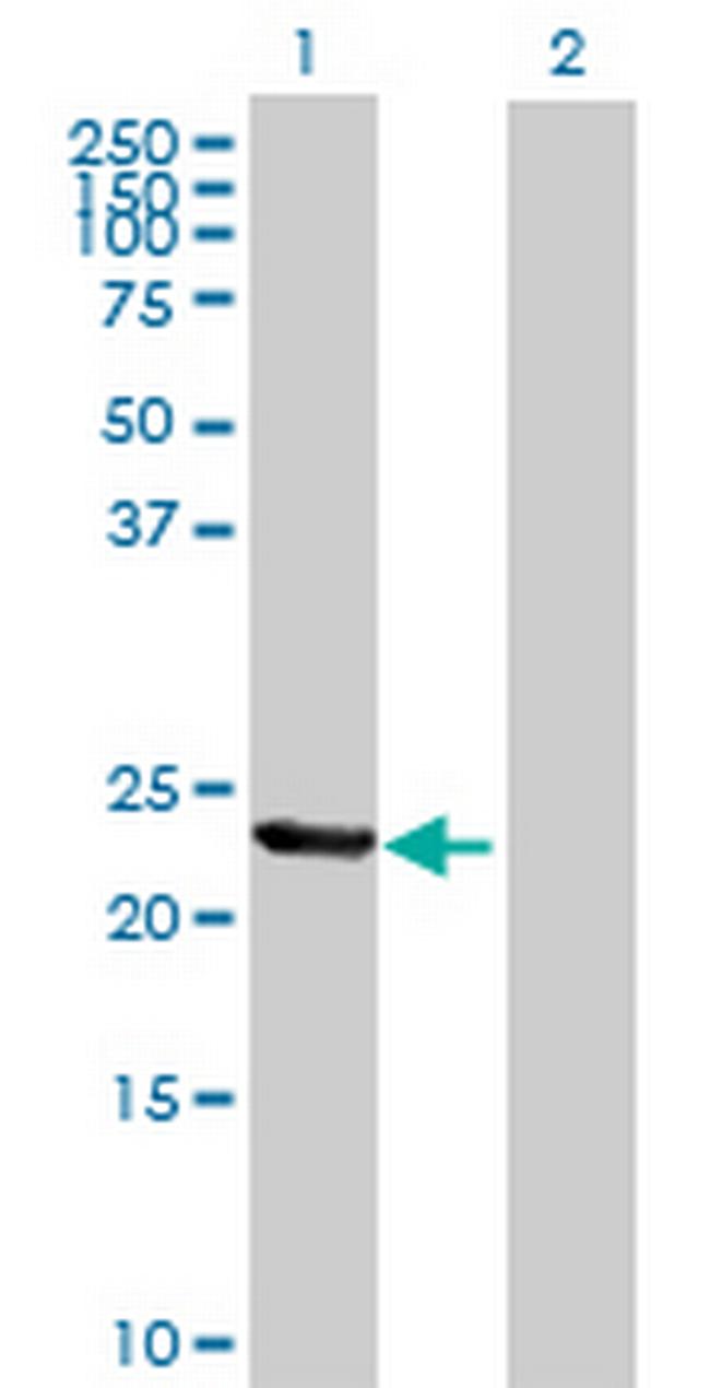 TIA1 Antibody in Western Blot (WB)