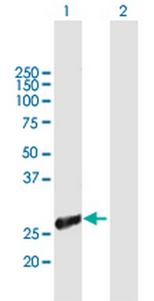TIAL1 Antibody in Western Blot (WB)