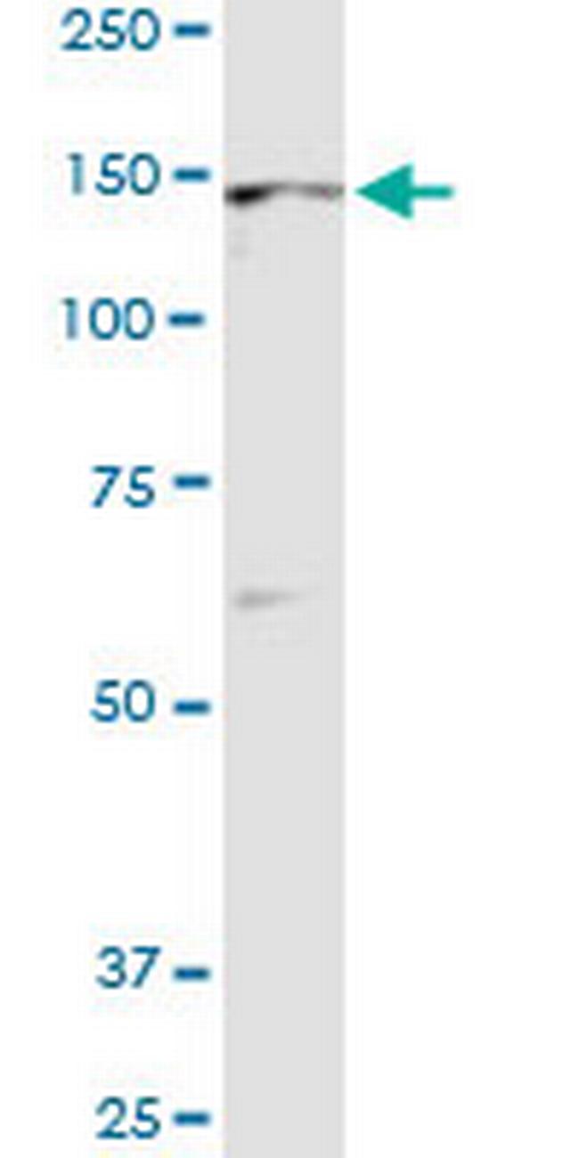 TIE1 Antibody in Western Blot (WB)