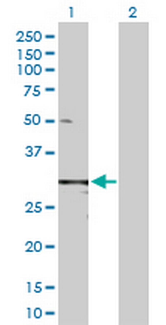 TIMP1 Antibody in Western Blot (WB)