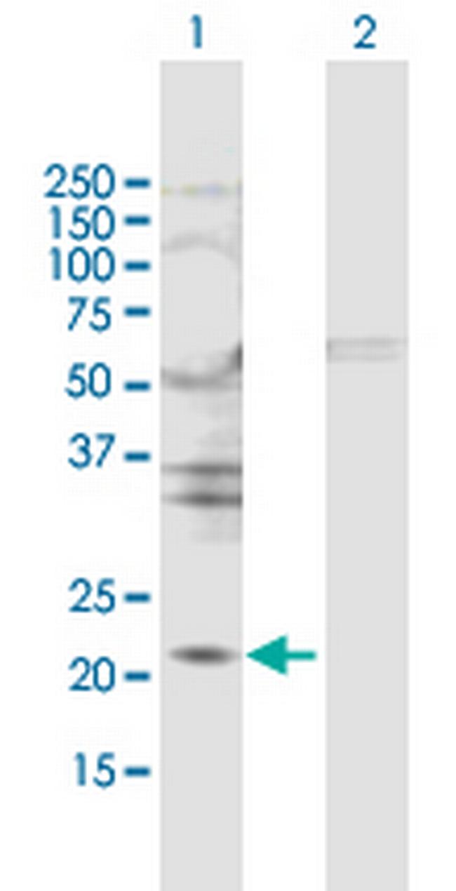 TIMP2 Antibody in Western Blot (WB)