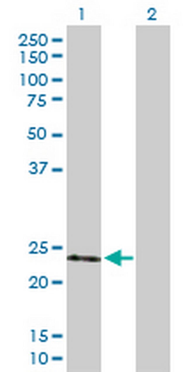TIMP2 Antibody in Western Blot (WB)