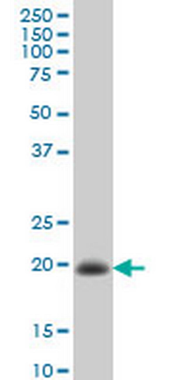 TIMP2 Antibody in Western Blot (WB)
