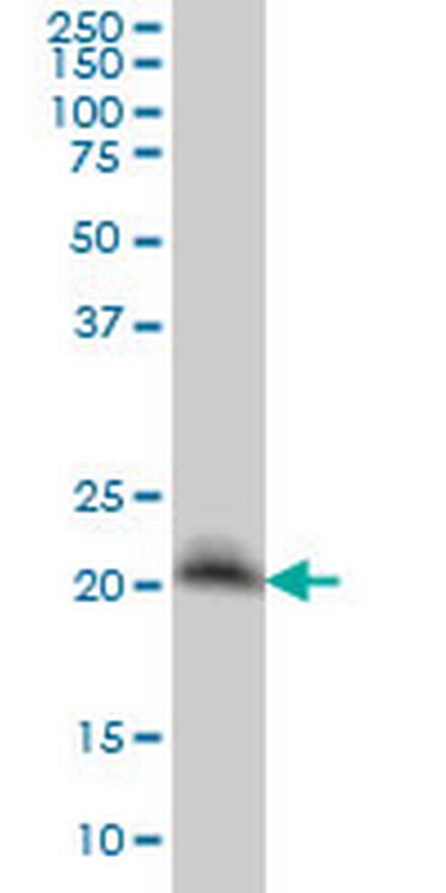 TIMP2 Antibody in Western Blot (WB)