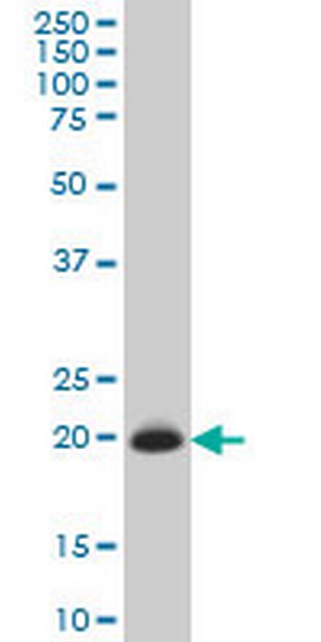 TIMP2 Antibody in Western Blot (WB)