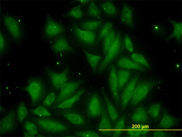 TIMP2 Antibody in Immunocytochemistry (ICC/IF)