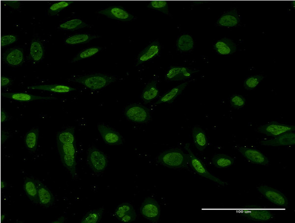 NKX2-1 Antibody in Immunocytochemistry (ICC/IF)