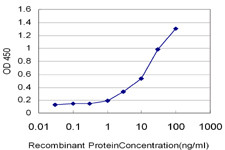 TK1 Antibody in ELISA (ELISA)