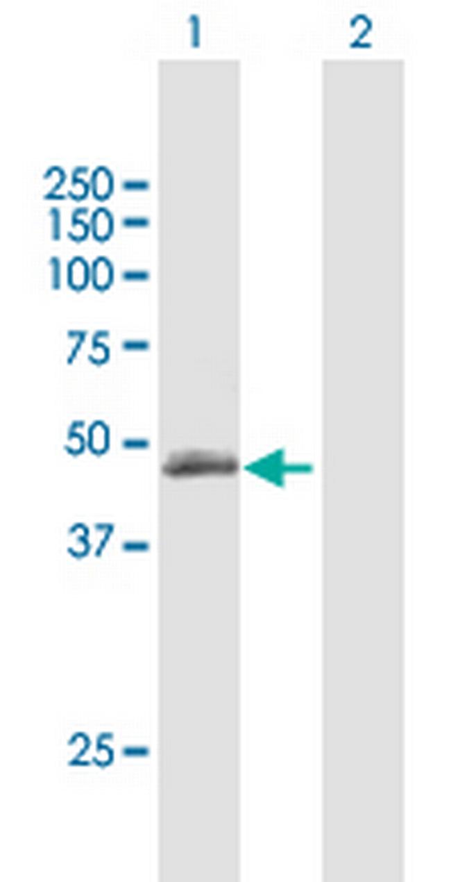 TLL1 Antibody in Western Blot (WB)