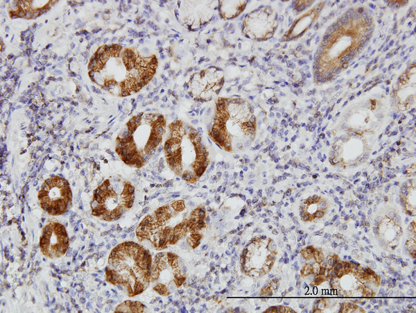 TLN1 Antibody in Immunohistochemistry (Paraffin) (IHC (P))